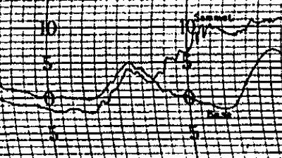 Weather observations of the Eiffel Tower from 1890 to 1894.php